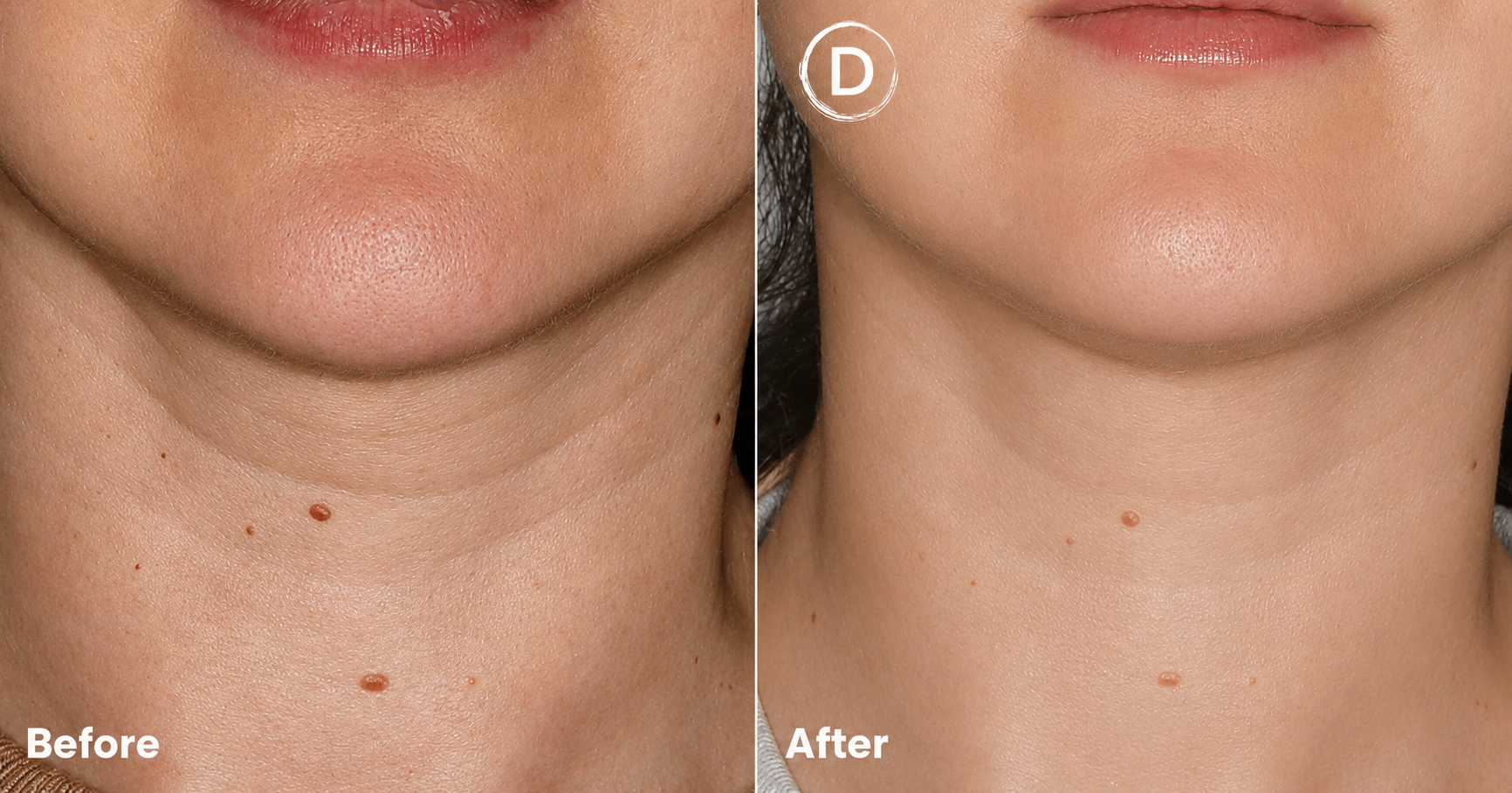 The GlowHive Face + Neck LED System